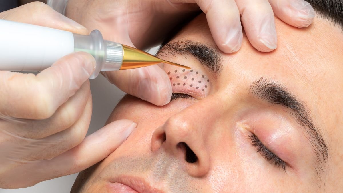 Plasma Pen